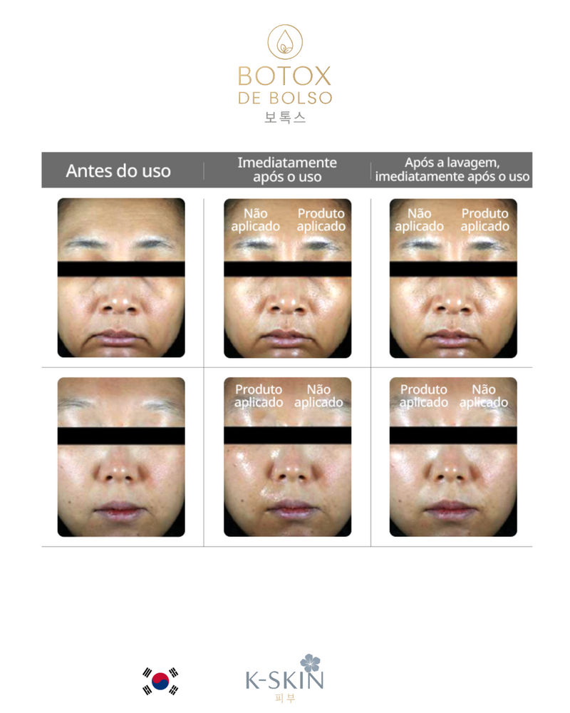 Botox de Bolso ®️ | 주머니 보톡스