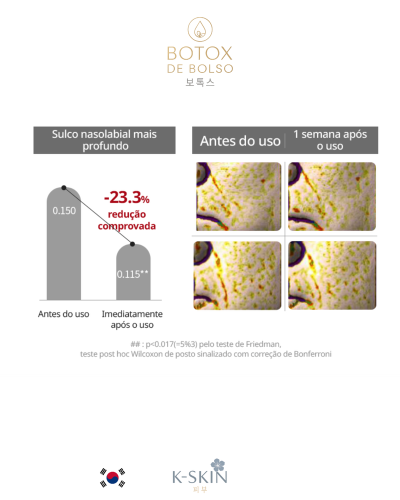 Botox de Bolso ®️ | 주머니 보톡스