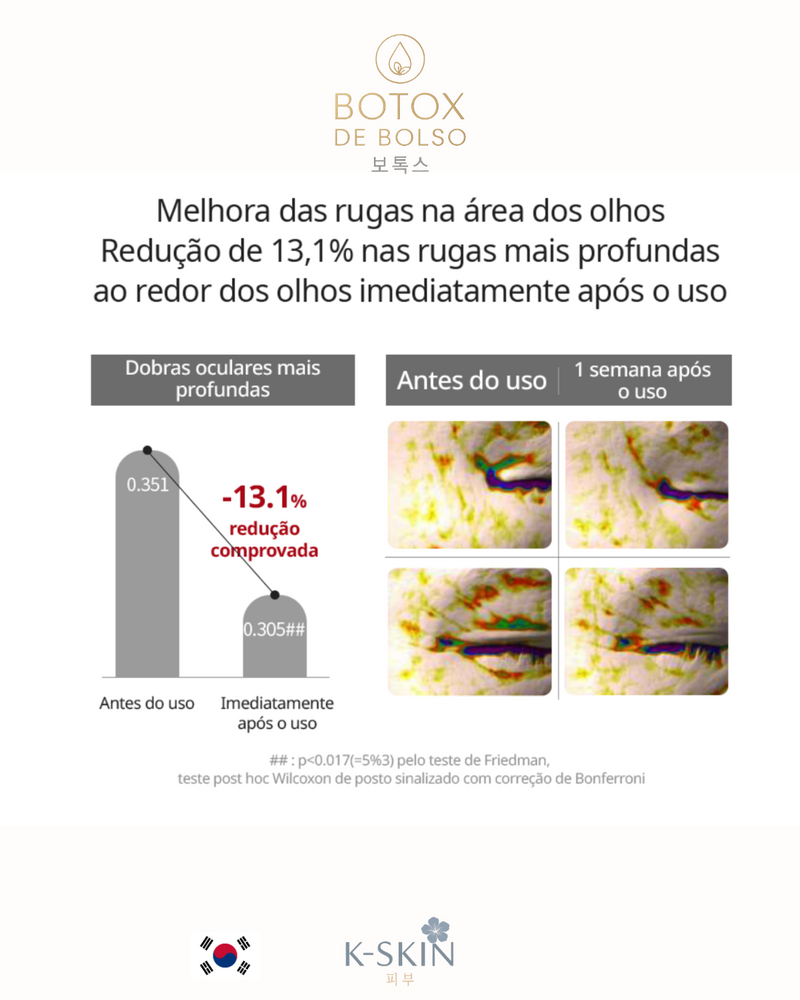 Botox de Bolso ®️ | 주머니 보톡스
